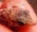 tn009.gif