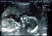 tnweb_04profile_19wks.jpg