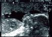 tnweb_05profilecu_19wks.jpg